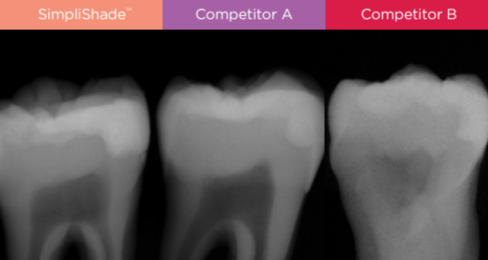 Radiograph comparison